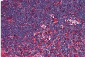 Human Thymus (formalin-fixed, paraffin-embedded) stained with TRDMT1 antibody ABIN290198 at 5 ug/ml followed by biotinylated anti-mouse IgG secondary antibody ABIN481714, alkaline phosphatase-streptavidin and chromogen. (Dnmt2 antibody)