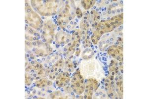 Immunohistochemistry of paraffin-embedded mouse kidney using AKR1A1 antibody. (AKR1A1 antibody  (AA 1-325))