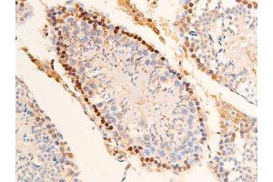 Immunohistochemistry (IHC) image for anti-Checkpoint Kinase 2 (CHEK2) (pThr383) antibody (ABIN6256552)