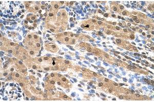 Human kidney (Eukaryotic Translation Initiation Factor 3, Subunit M (EIF3M) (N-Term) antibody)