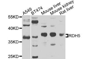 Western blot analysis of extracts of various cells, using RDH5 antibody. (RDH5 antibody)