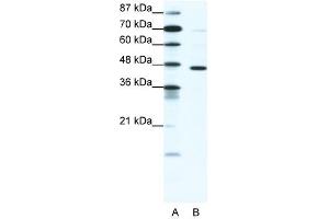 GABRP antibody (20R-1332) used at 0.