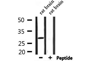 Western blot analysis of extracts from rat brain, using ATF1 Antibody. (AFT1 antibody  (Internal Region))