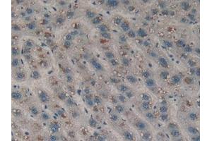 Immunohistochemistry (IHC) image for anti-Discoidin Domain Receptor tyrosine Kinase 1 (DDR1) (AA 568-829) antibody (ABIN7444106)