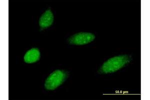 Immunofluorescence of purified MaxPab antibody to MMS19 on HeLa cell. (MMS19 antibody  (AA 1-293))