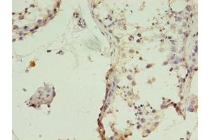 Immunohistochemistry of paraffin-embedded human testis tissue using ABIN7159886 at dilution of 1:100 (TIMM1B (AA 1-103) antibody)