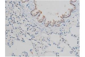 ABIN6267398 at 1/200 staining Rat lung tissue sections by IHC-P.