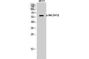 Western Blotting (WB) image for anti-V-Akt Murine Thymoma Viral Oncogene Homolog 1 (AKT1) (pSer473) antibody (ABIN3179731) (AKT1 antibody  (pSer473))
