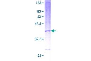 Image no. 1 for NADH Dehydrogenase (Ubiquinone) 1 beta Subcomplex, 3, 12kDa (NDUFB3) (AA 1-98) protein (GST tag) (ABIN1312252) (NDUFB3 Protein (AA 1-98) (GST tag))