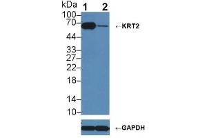 anti-Keratin 2 (KRT2) (AA 368-507) antibody