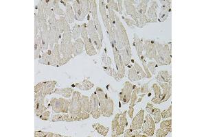 Immunohistochemistry of paraffin-embedded mouse heart using FGF2 antibody (ABIN1872685) at dilution of 1:100 (40x lens). (FGF2 antibody)