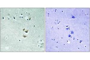 Immunohistochemistry analysis of paraffin-embedded human brain tissue, using PRKCA (Ab-657) Antibody. (PKC alpha antibody  (AA 623-672))