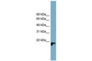 Image no. 1 for anti-Chromosome 1 Open Reading Frame 93 (C1orf93) (AA 137-186) antibody (ABIN6743682) (C1orf93 antibody  (AA 137-186))