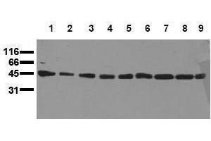 Western Blotting (WB) image for anti-Mitogen-Activated Protein Kinase Kinase 1 (MAP2K1) antibody (ABIN126837) (MEK1 antibody)