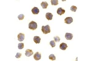 Immunohistochemistry (IHC) image for anti-B-Cell CLL/lymphoma 2 (BCL2) (Middle Region) antibody (ABIN1030884) (Bcl-2 antibody  (Middle Region))