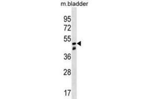 Western Blotting (WB) image for anti-Sorting Nexin 8 (SNX8) antibody (ABIN3000289) (SNX8 antibody)