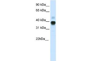 WB Suggested Anti-HOXA11 Antibody Titration:  0. (Homeobox A11 antibody  (C-Term))