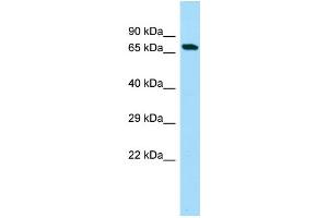 WB Suggested Anti-C20orf112 Antibody Titration: 1. (C20orf112 antibody  (N-Term))