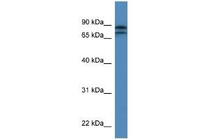 WB Suggested Anti-KLHL22 Antibody Titration: 0.