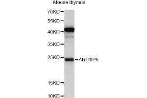 Western blot analysis of extracts of mouse thymus, using ARL6IP5 antibody (ABIN6292619) at 1:1000 dilution.