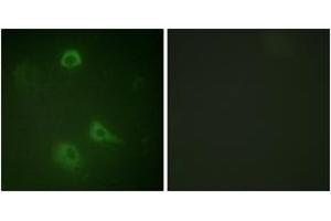Immunofluorescence analysis of A549 cells, using NMDAR1 (Phospho-Ser890) Antibody. (GRIN1/NMDAR1 antibody  (pSer890))