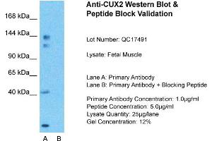 Host:  Rabbit  Target Name:  CUX2  Sample Type:  Fetal Muscle  Lane A:  Primary Antibody  Lane B:  Primary Antibody + Blocking Peptide  Primary Antibody Concentration:  1ug/ml  Peptide Concentration:  5ug/ml  Lysate Quantity:  25ug/lane/Lane  Gel Concentration:  0. (CUX2 antibody  (N-Term))