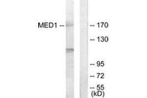 Western blot analysis of extracts from Jurkat cells, using MED1 Antibody. (MED1 antibody  (AA 641-690))