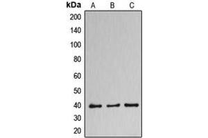 Western blot analysis of DNAJB11 expression in HuvEc (A), NCIH460 (B), MCF7 (C) whole cell lysates. (DNAJB11 antibody  (Center))