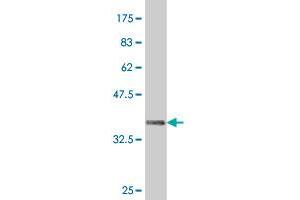 Western Blot detection against Immunogen (37. (HHEX antibody  (AA 133-237))