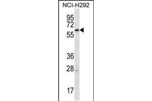 Western blot analysis in NCI-H292 cell line lysates (35ug/lane). (MBTPS2 antibody  (N-Term))