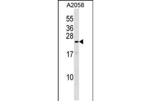 Western blot analysis in A2058 cell line lysates (35ug/lane). (KRAB Box Domain Containing 4 (KRBOX4) (AA 96-125), (C-Term) antibody)