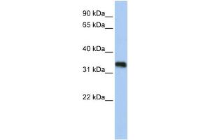 WB Suggested Anti-C6orf140 Antibody Titration:  0.