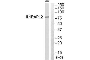 Western Blotting (WB) image for anti-Interleukin 1 Receptor Accessory Protein-Like 2 (IL1RAPL2) (Internal Region) antibody (ABIN1852772) (IL1RAPL2 antibody  (Internal Region))
