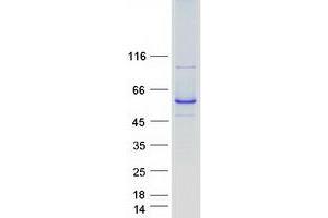 Western Blotting (WB) image for Cytochrome P450, Family 2, Subfamily C, Polypeptide 8 (CYP2C8) protein (Myc-DYKDDDDK Tag) (ABIN2712766)