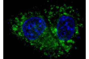 Fluorescent confocal image of HepG2 cells stained with ALDH1A1 antibody. (ALDH1A1 antibody)