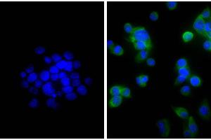 Human pancreatic carcinoma cell line MIA PaCa-2 was stained with Mouse Anti-Cytokeratin 18-UNLB, and DAPI. (Goat anti-Mouse IgG (Heavy & Light Chain) Antibody (Biotin) - Preadsorbed)