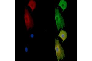 ABIN7095401 and ABIN7099458 staining  cells by IF/ICC.