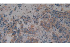 Immunohistochemistry (IHC) image for anti-alpha-2-Glycoprotein 1, Zinc-Binding (AZGP1) (AA 148-298) antibody (ABIN7438511)