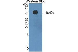 Detection of Recombinant ADCY8, Human using Polyclonal Antibody to Adenylate Cyclase 8, Brain (ADCY8) (ADCY8 antibody  (AA 234-371))