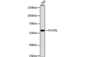 Western blot analysis of extracts of Raji cells, using FLVCR1 antibody (ABIN7267164) at 1:1000 dilution. (FLVCR antibody  (AA 250-350))
