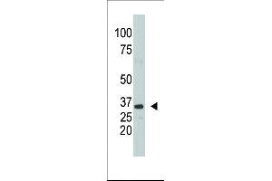 The anti-SULT1A1 Pab (ABIN389136 and ABIN2839312) is used in Western blot to detect SULT1A1 in mouse kidney tissue lysate. (SULT1A1 antibody  (AA 128-160))