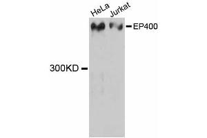 Western blot analysis of extracts of various cell lines, using EP400 antibody (ABIN5997682) at 1:3000 dilution. (EP400 antibody)