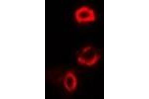 Immunofluorescent analysis of OGDH staining in U2OS cells. (alpha KGDHC antibody)