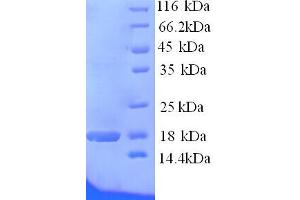 SDS-PAGE (SDS) image for MSA2 (AA 109-246) protein (His tag) (ABIN5714128) (MSA2 (AA 109-246) protein (His tag))