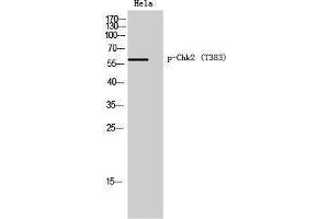 Western Blotting (WB) image for anti-Checkpoint Kinase 2 (CHEK2) (pThr383) antibody (ABIN3182426) (CHEK2 antibody  (pThr383))