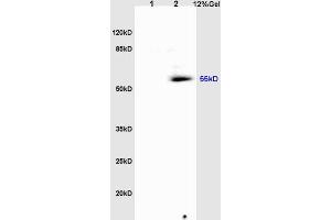 L1 rat heart lysates, L2 rat brain lysates probed: Anti-Tubulin-alpha (ABIN725630) at 1:200 in 4 °C. (alpha Tubulin antibody  (AA 375-448))