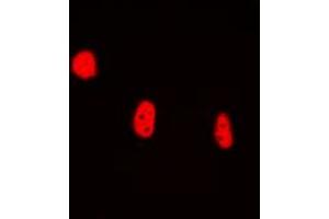 Immunofluorescent analysis of BRAF35 staining in HEK293T cells.