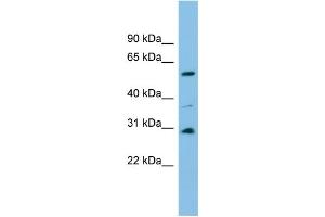 WB Suggested Anti-DUS1L Antibody Titration: 0.