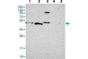 Western blot analysis of Lane 1: RT-4, Lane 2: U-251 MG, Lane 3: Human Plasma, Lane 4: Liver, Lane 5: Tonsil with FBRS polyclonal antibody  at 1:250-1:500 dilution.