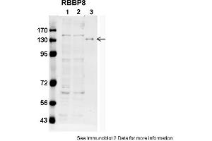 Sample type: 1. (Retinoblastoma Binding Protein 8 antibody  (C-Term))
